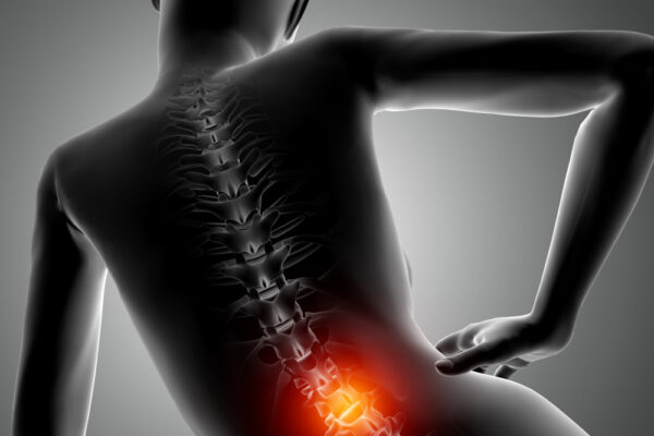 Non-Surgical Back Pain Treatment in Dallas