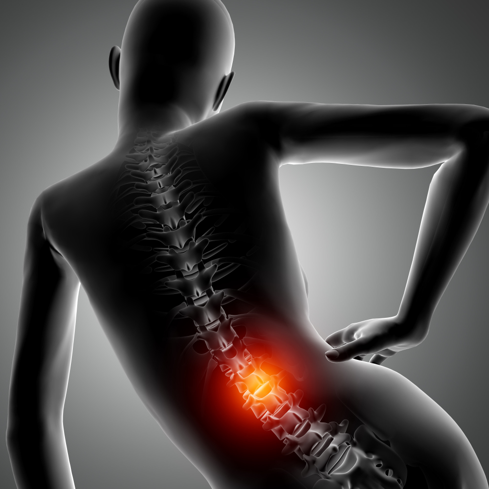 Non-Surgical Back Pain Treatment in Dallas