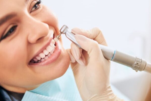 Dental Cleaning Services in Houston