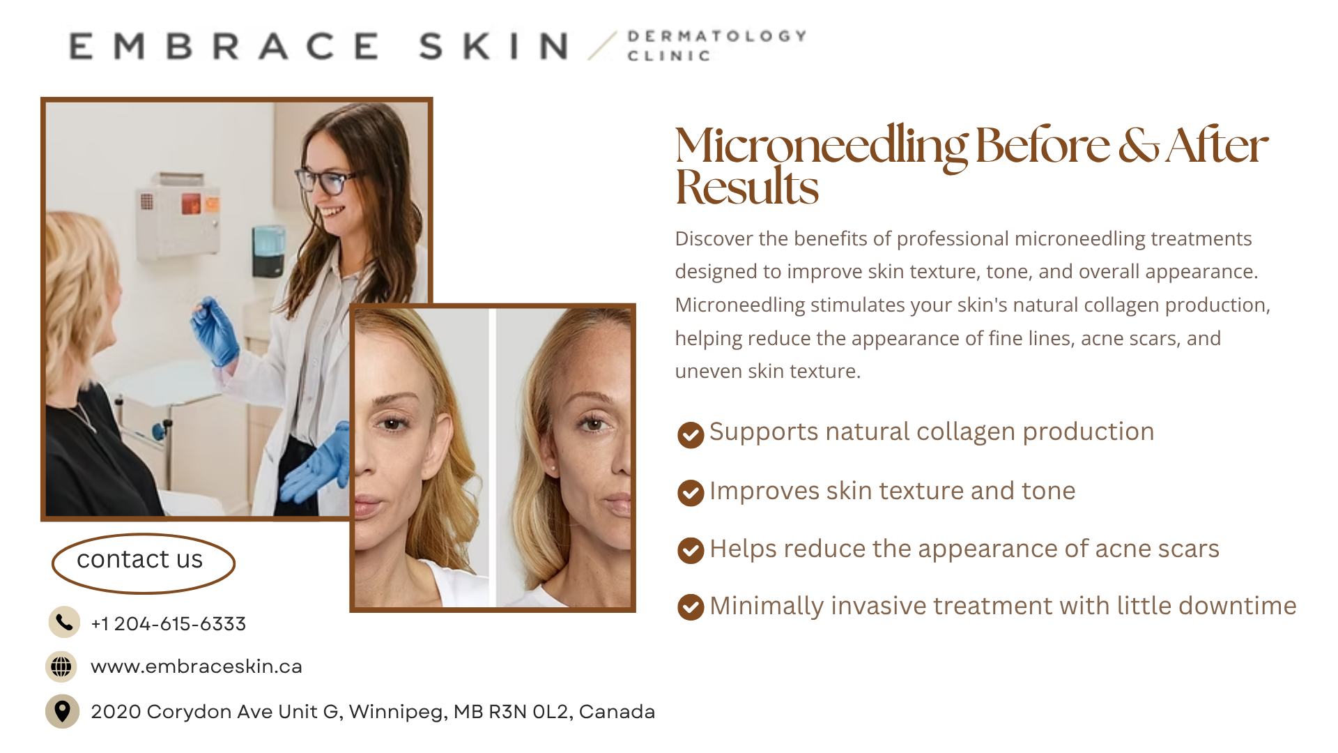 https://www.embraceskin.ca/micro-needling-and-prp-treatment-in-winnipeg