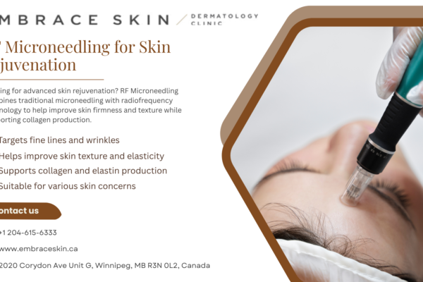 microneedling winnipeg