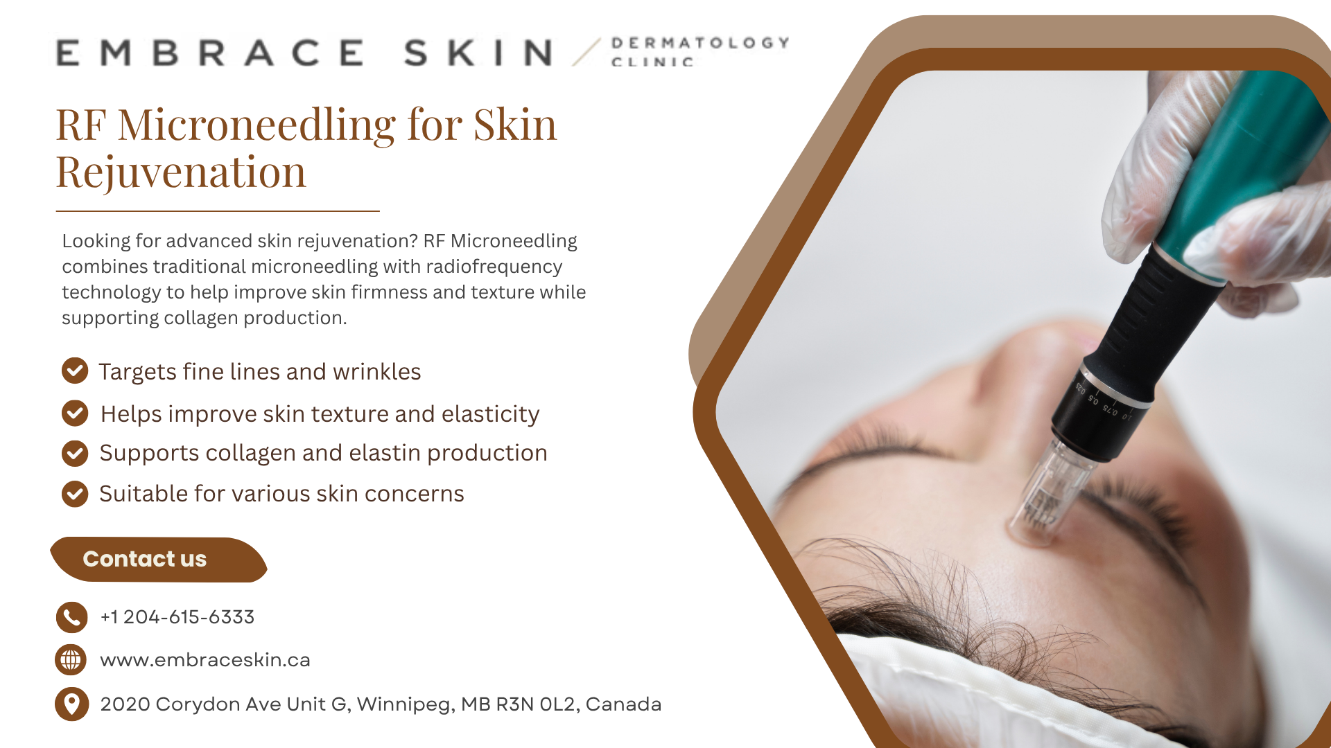 microneedling winnipeg