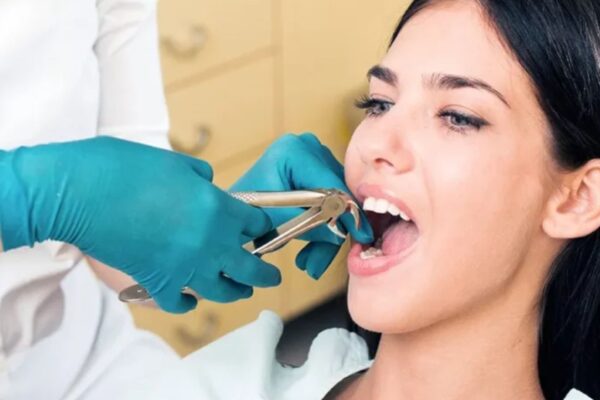 Wisdom Teeth Extractions: Signs It's Time to Remove Your Wisdom Teeth
