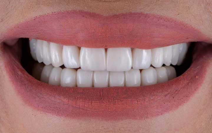 Achieve Perfect Facial Harmony with the Best Dentist Lahore