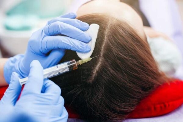 hair loss clinic UK