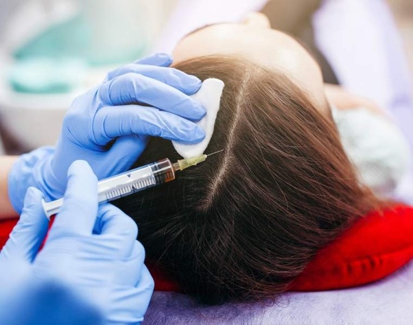 hair loss clinic UK