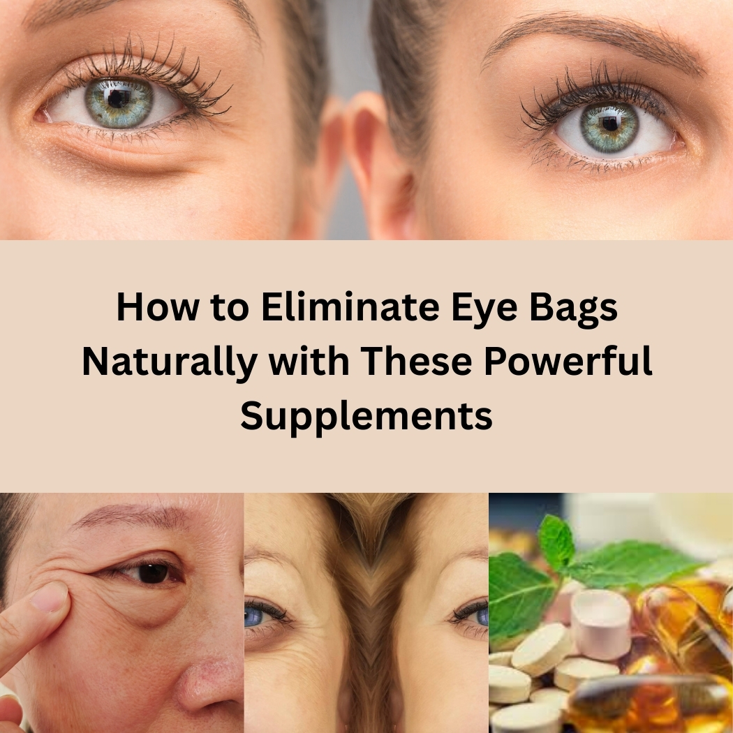 How to Eliminate Eye Bags Naturally