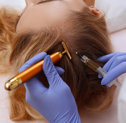 PRP Therapy for Hair Loss in Riyadh