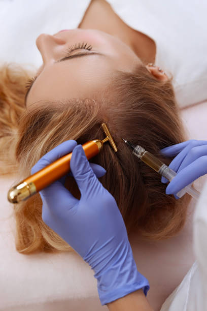 PRP Therapy for Hair Loss in Riyadh