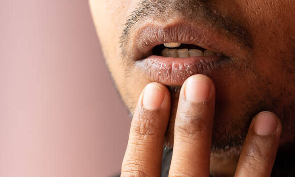 Smoker’s Lips Treatment in Riyadh