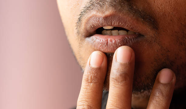 Smoker’s Lips Treatment in Riyadh