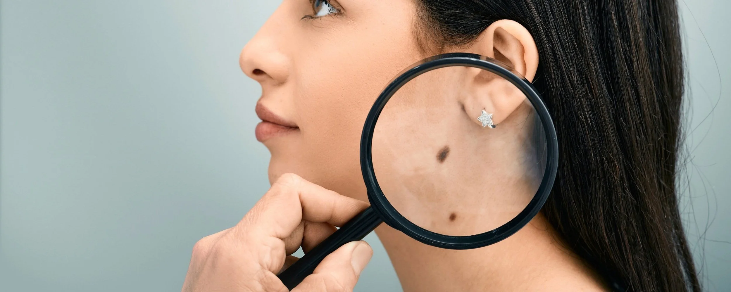 mole assessment