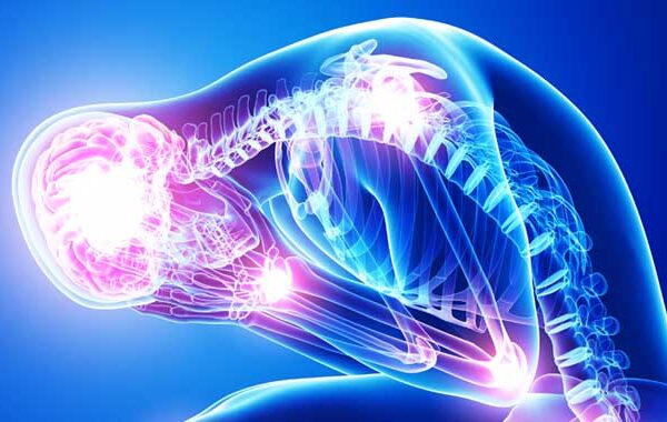 Ashwagandha Reduce Cortisol in Stressed Patients