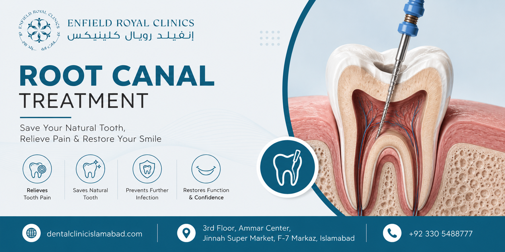 Protect Your Smile with Advanced Dental Care Root Canal Treatment in Islamabad Pakistan:
