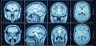 ct scan price in bangalore