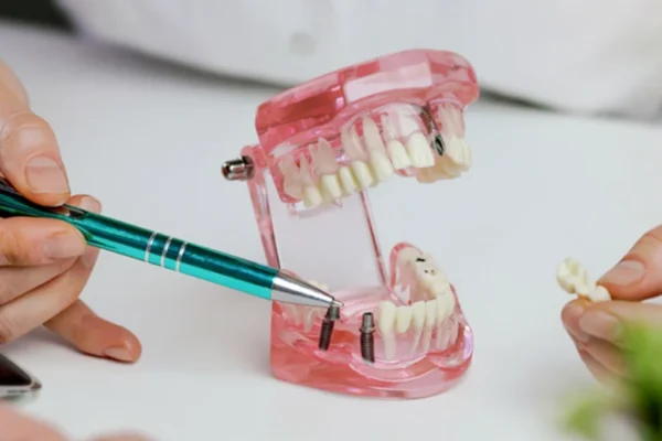 my glow up dentistry