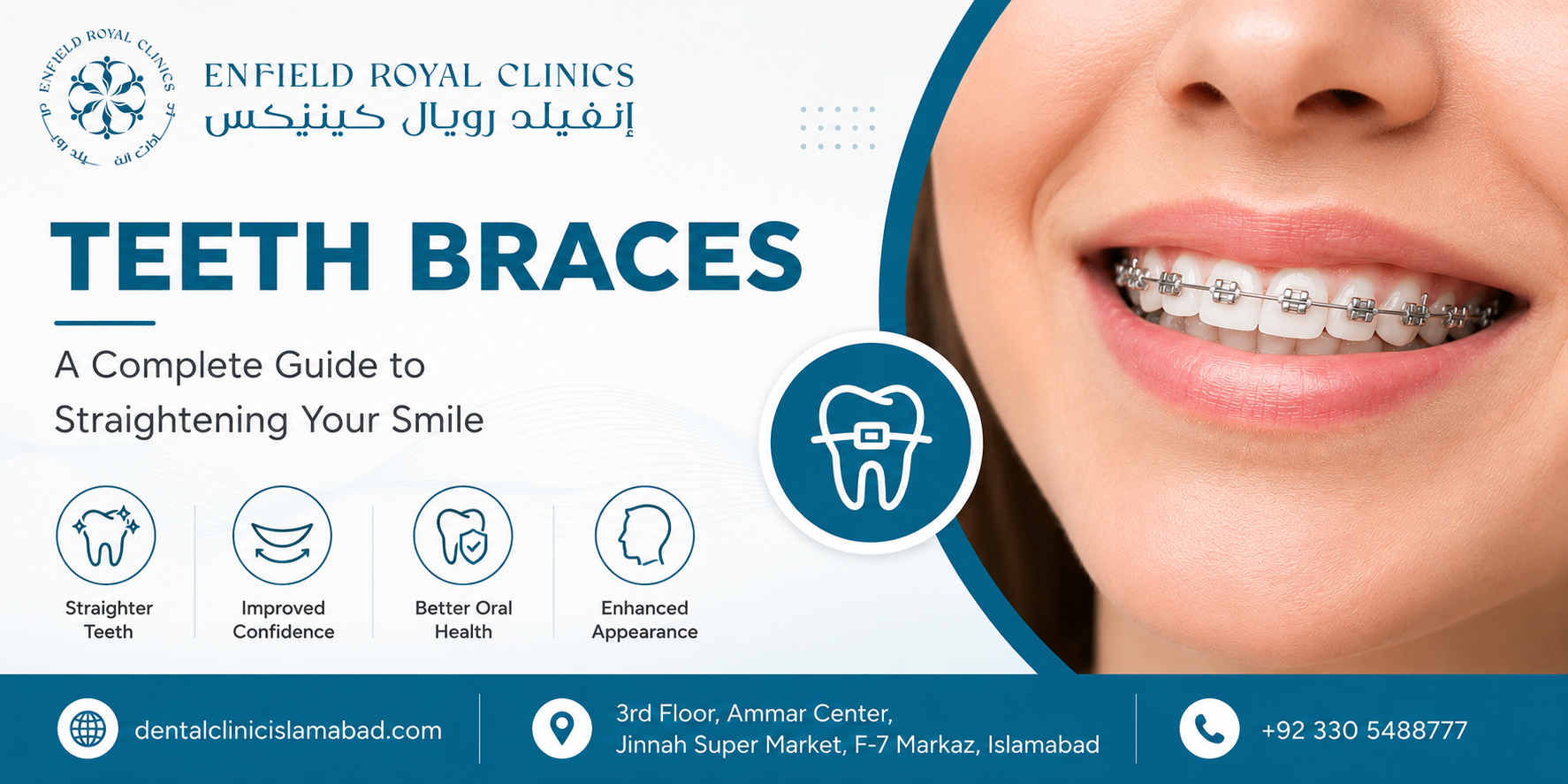 How Teeth Braces in Islamabad Pakistan Help Correct Cross bites and Improve Oral Function