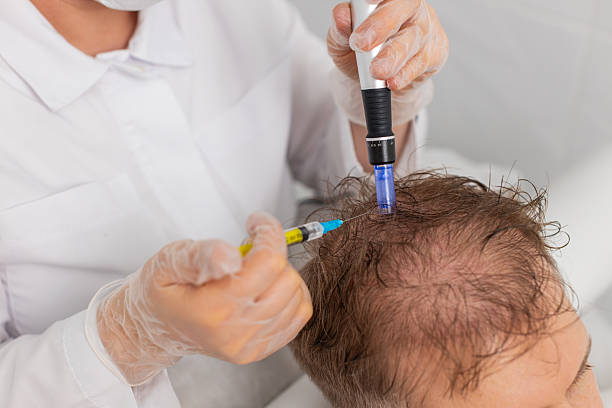 Supporting Hair Regrowth Through Advanced Regenerative Technology Exosome Hair Therapy in Islamabad: