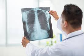 Digital X-Ray Near Me