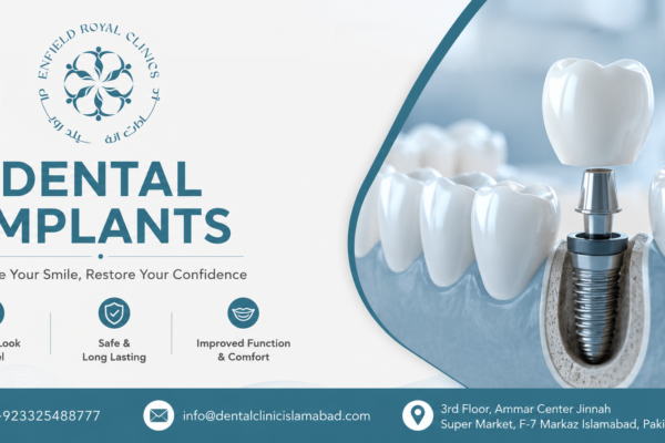 Best Dental Implants in Islamabad