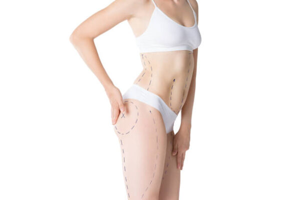 Body Contouring Treatment
