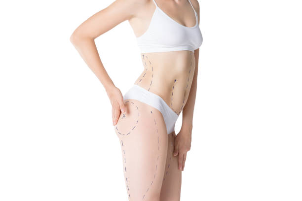 Body Contouring Treatment