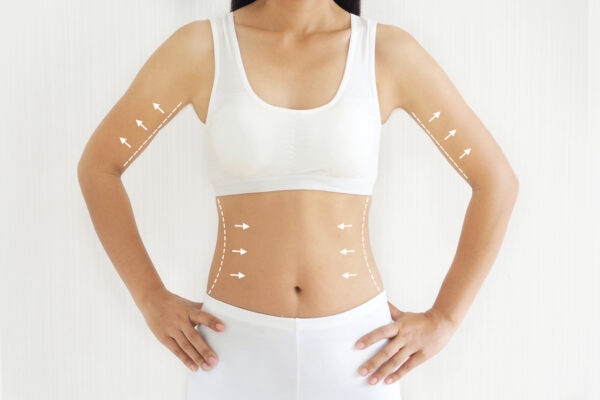 Body Contouring Treatment in Islamabad