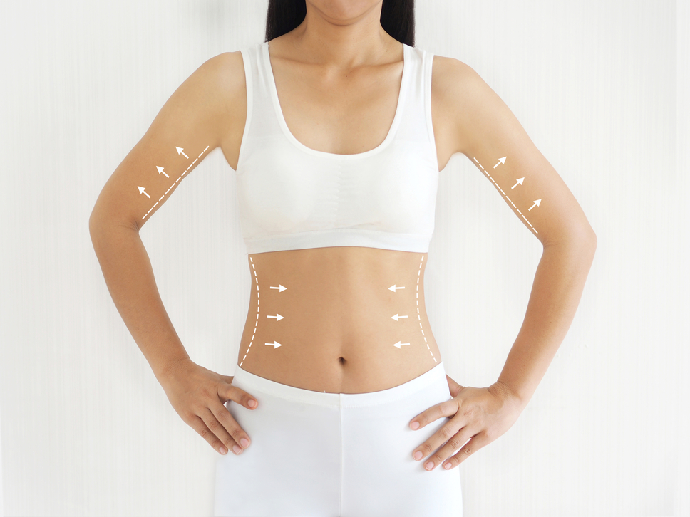 Body Contouring Treatment in Islamabad