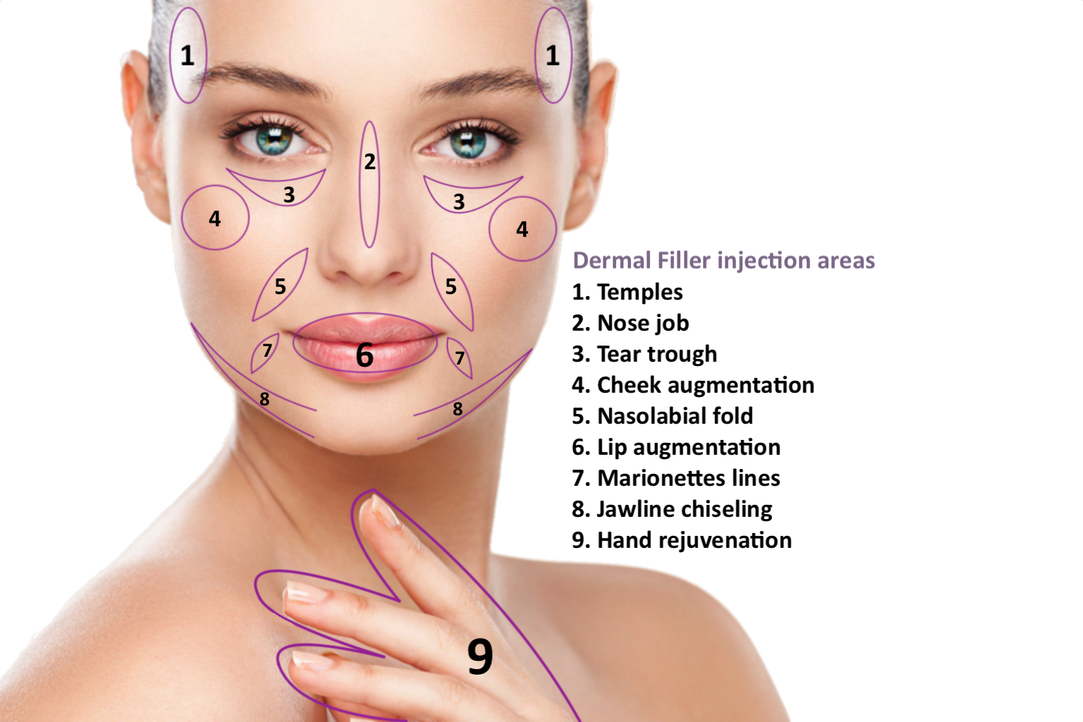 Dermal fillers injections in Islamabad (2)