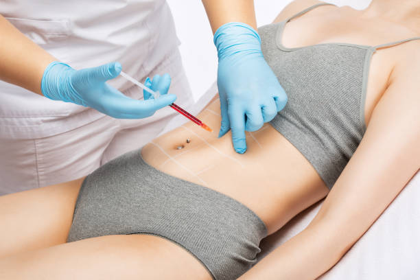 Fat Melting Injections in Riyadh