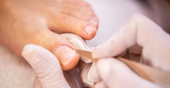 How to Trim Toenails Safely for Better Foot Health Edinburgh