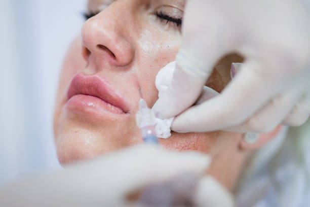 Skin Booster in Riyadh
