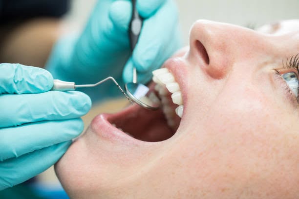 Teeth Cleaning In Adelaide South