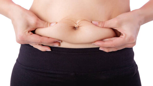 Tummy Tuck in Riyadh