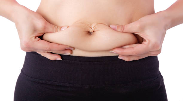 Tummy Tuck in Riyadh