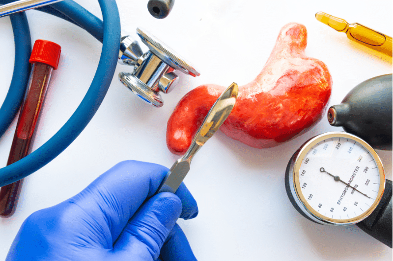 What You Really Need to Know Before Choosing Weight Loss Surgery