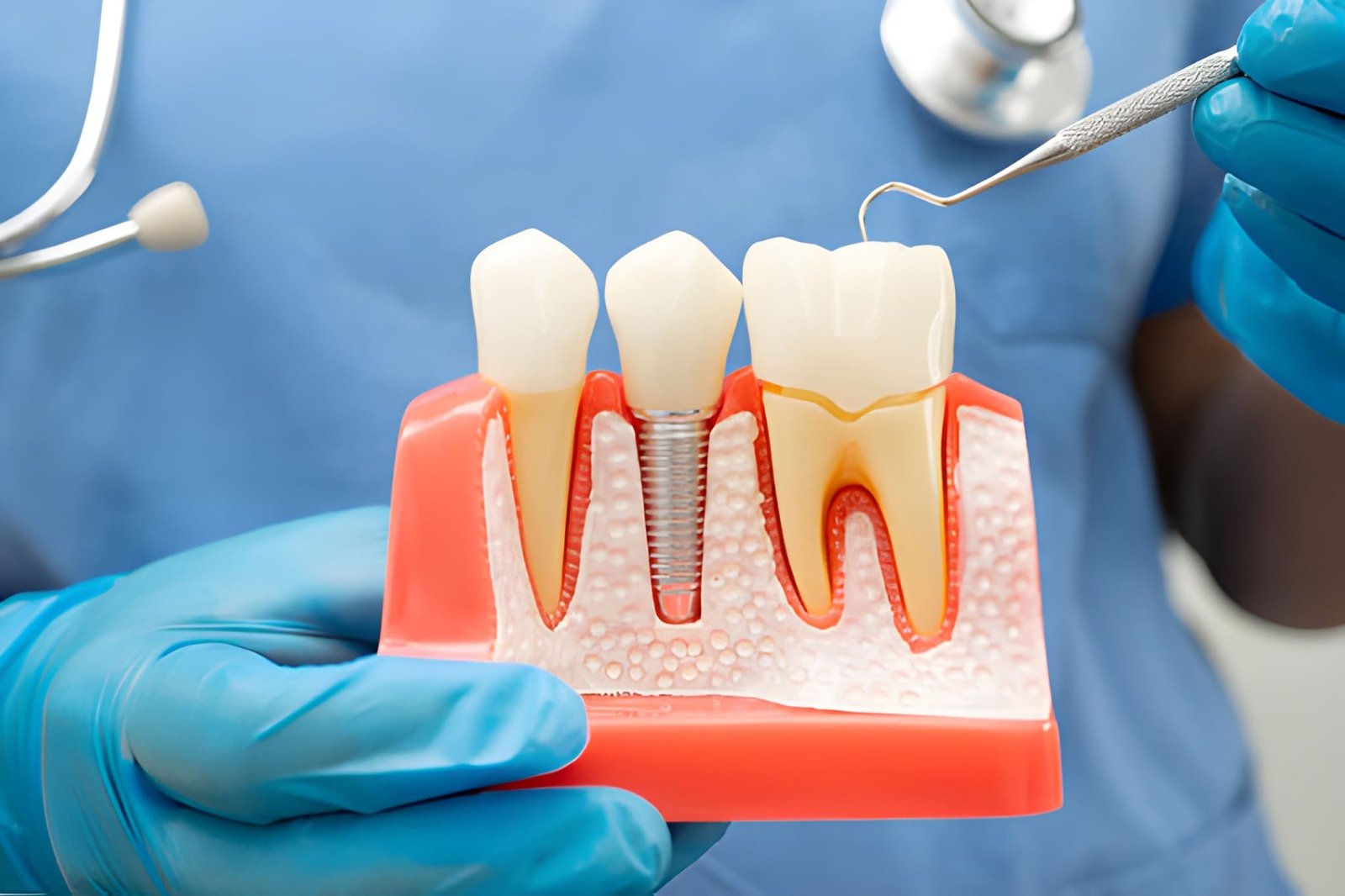 Expert Dental Implant Care in Aberdeen