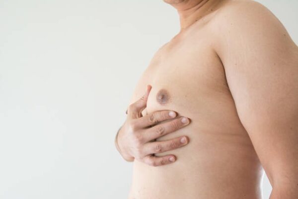Gynecomastia Surgery in Riyadh